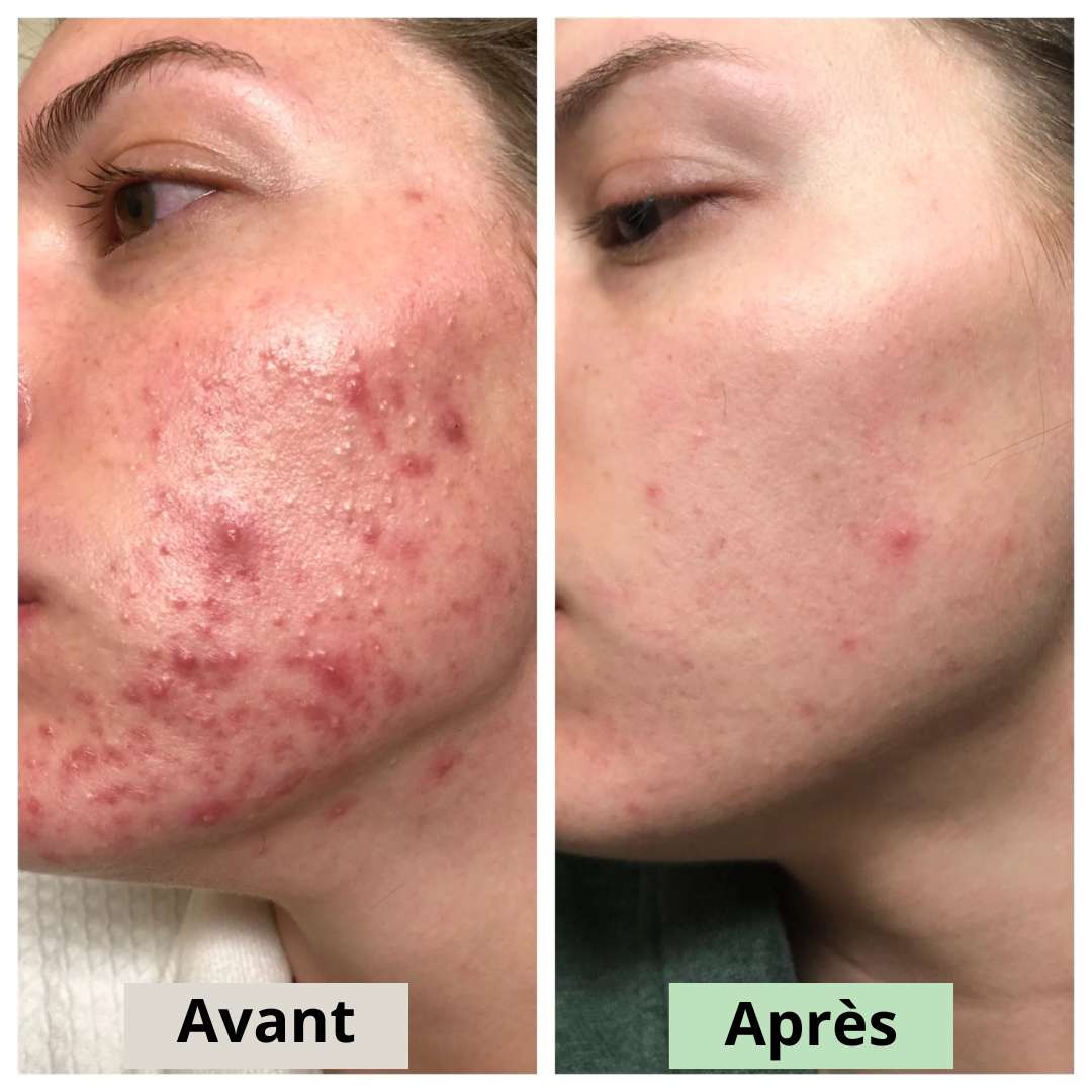 Avant
