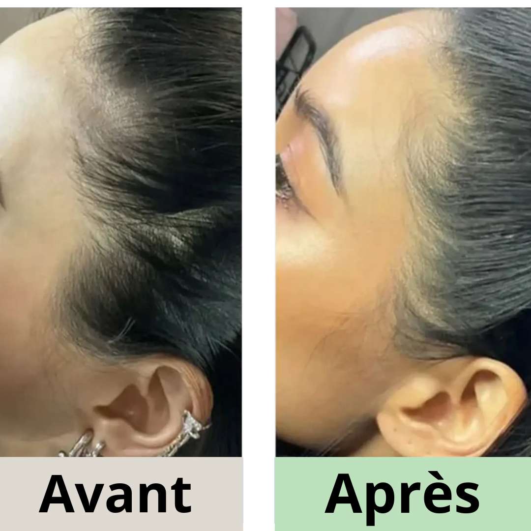 Avant