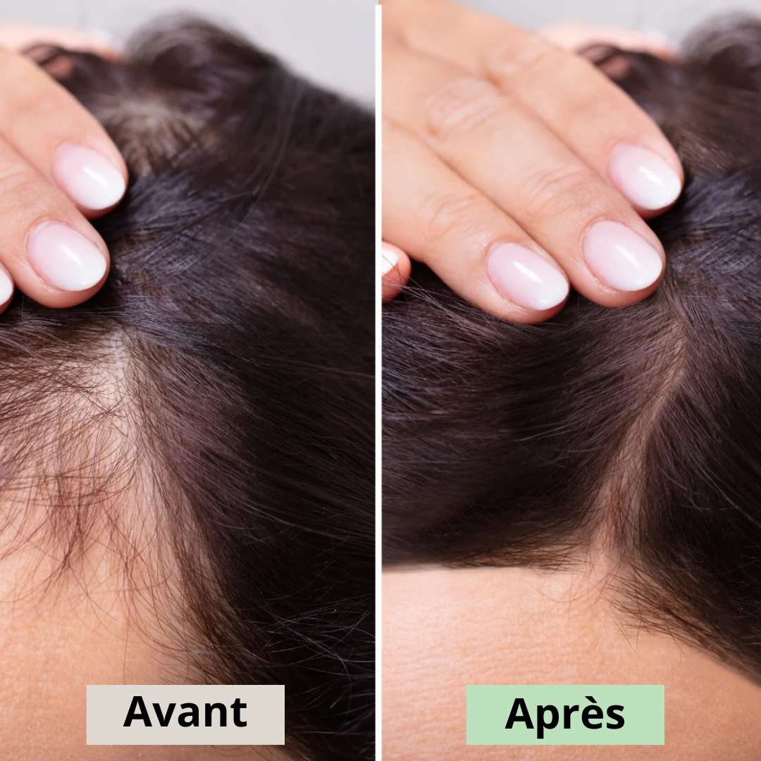 Avant