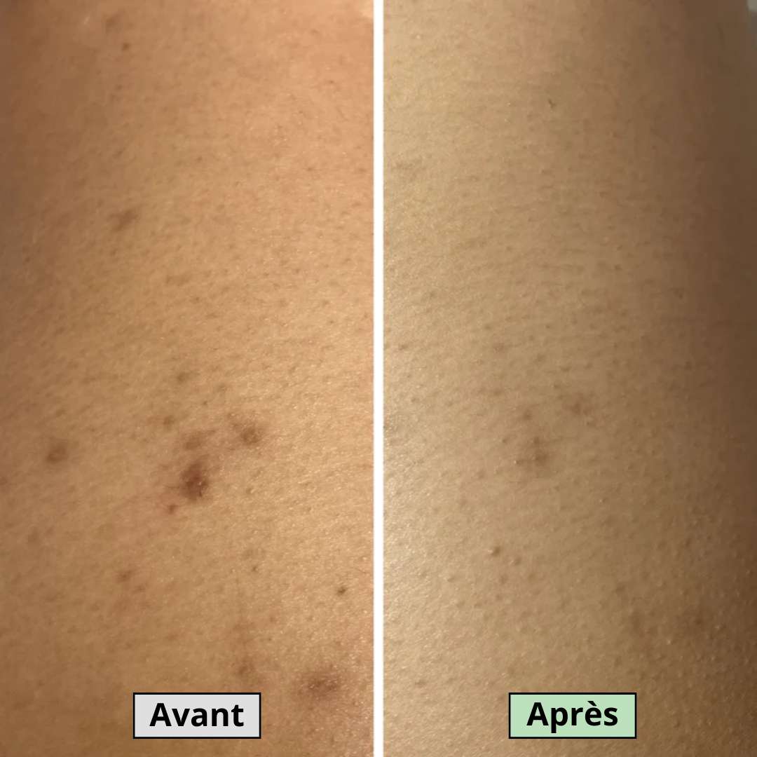 Avant