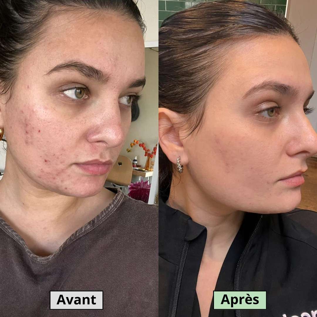 Avant
