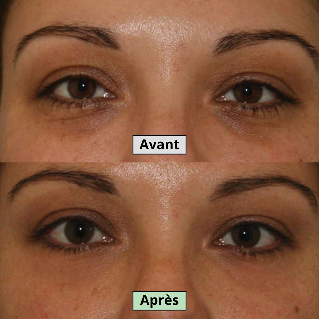 Avant