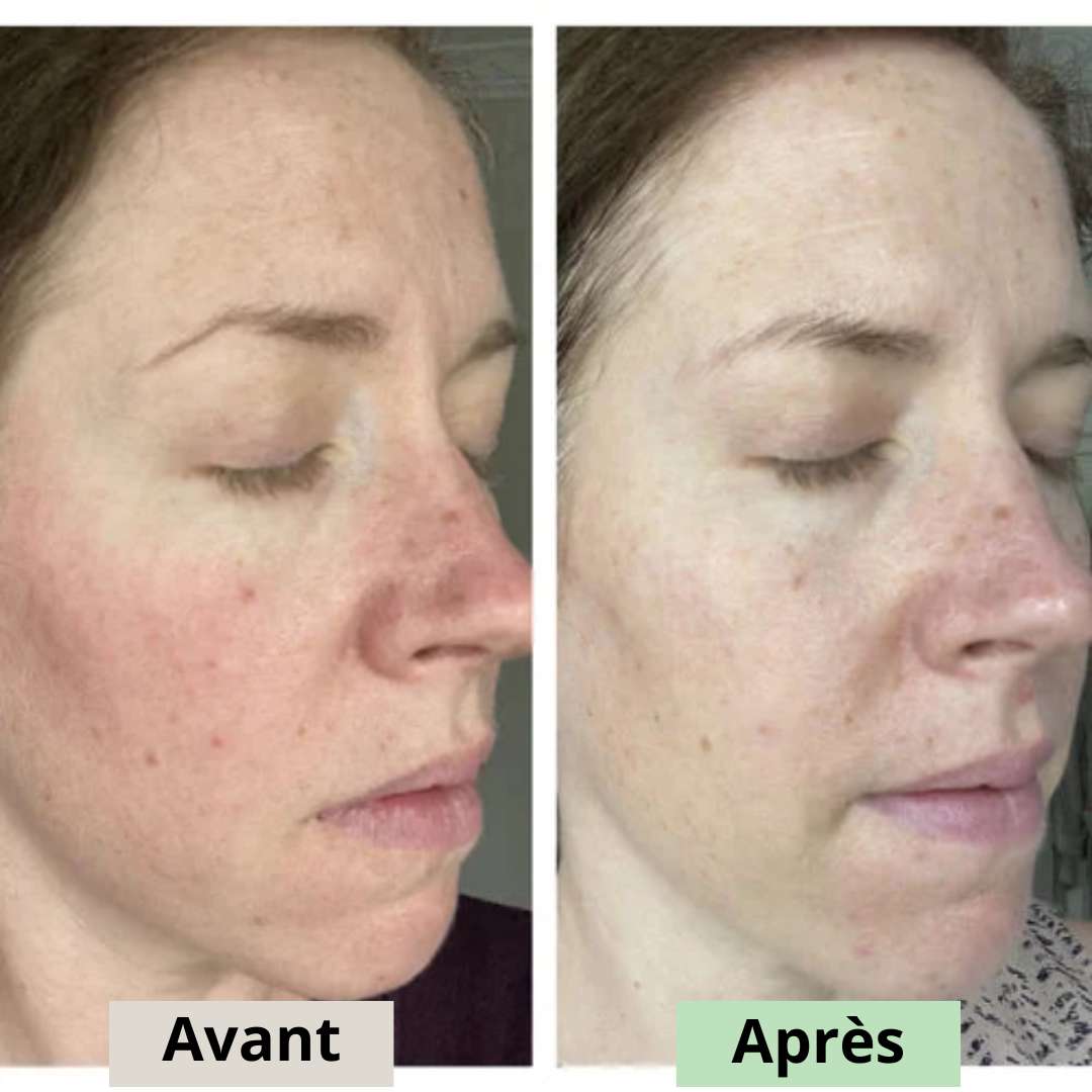 Avant
